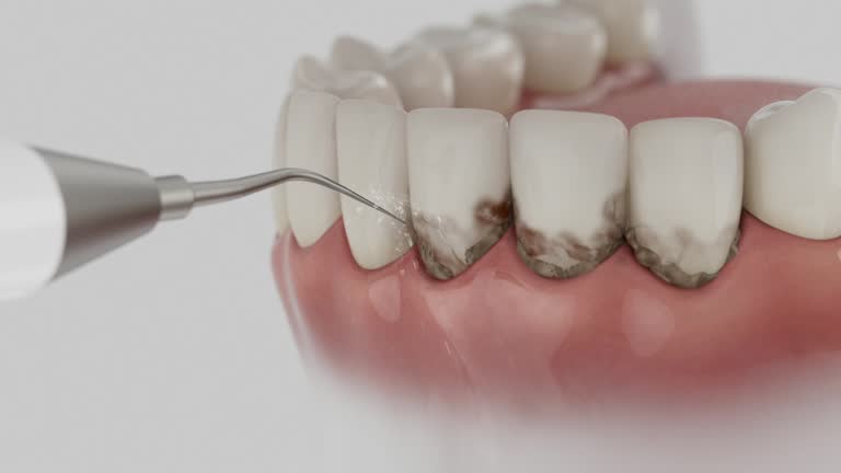 Reliable Dental Implants contractor in Mountain View, NC by Smile Center Dentistry
